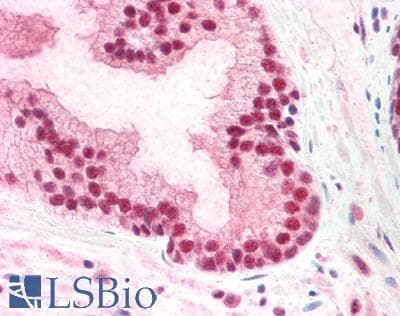 IHC-plus™ PUF60 Antibody (aa530-542)