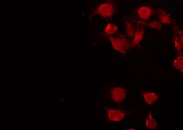 FUBP3 Antibody