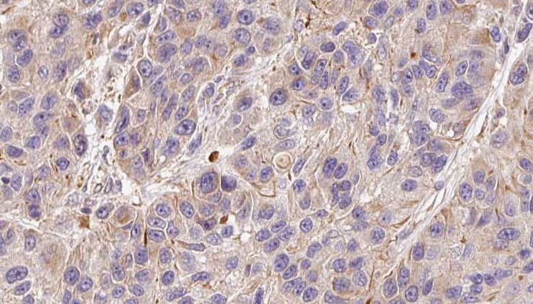 Polyclonal Rabbit anti-Human F5 / Factor Va Antibody (IHC, WB)