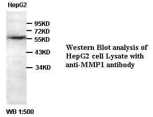 Polyclonal Rabbit anti-Human MMP1 Antibody (WB)
