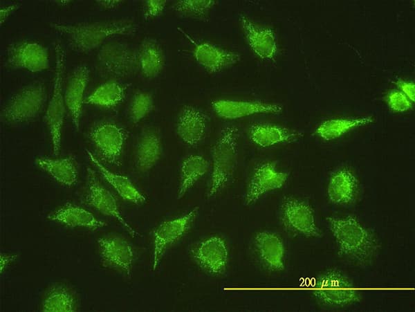 UBE2G1 Antibody (clone 1C12-1B2)