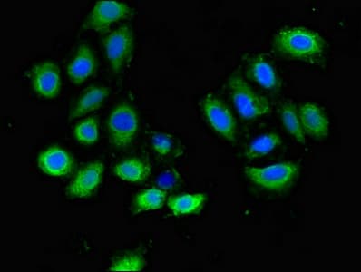Polyclonal Rabbit anti-Human PLXND1 / Plexin D1 Antibody (IHC, IF)