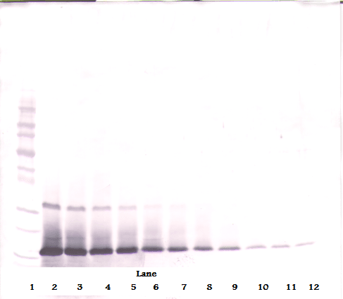 Polyclonal Rabbit anti-Mouse IL21 Antibody (WB)