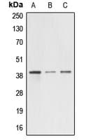 Alpha4GnT / A4GNT Antibody (Internal)