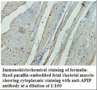 APIP Antibody (aa2-156)