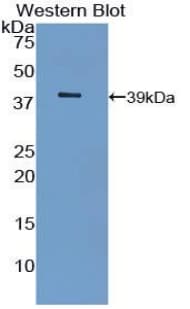 INSR / Insulin Receptor Antibody (aa1027-1364)