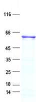 Human NKD2 Protein (Recombinant His, N-Terminal)