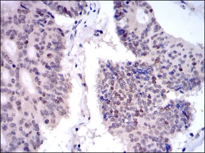 KIF22 / OBP Antibody (clone 1E3)