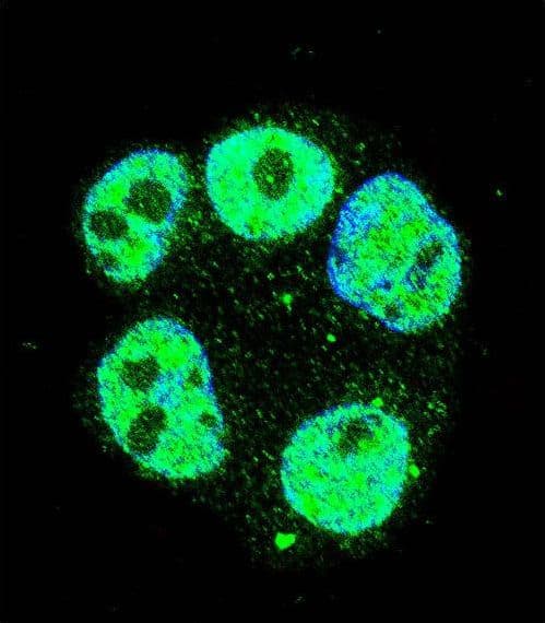 METTL2B Antibody (aa329-359)