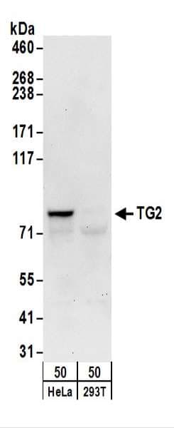 TGM2 / Transglutaminase 2 Antibody (aa625-675)