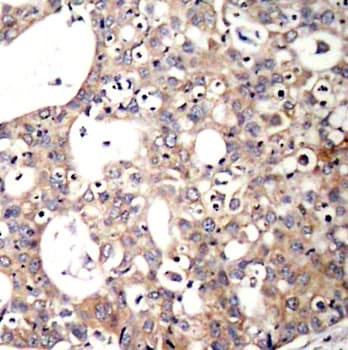 p66 / SHC Antibody (phospho-Tyr427)