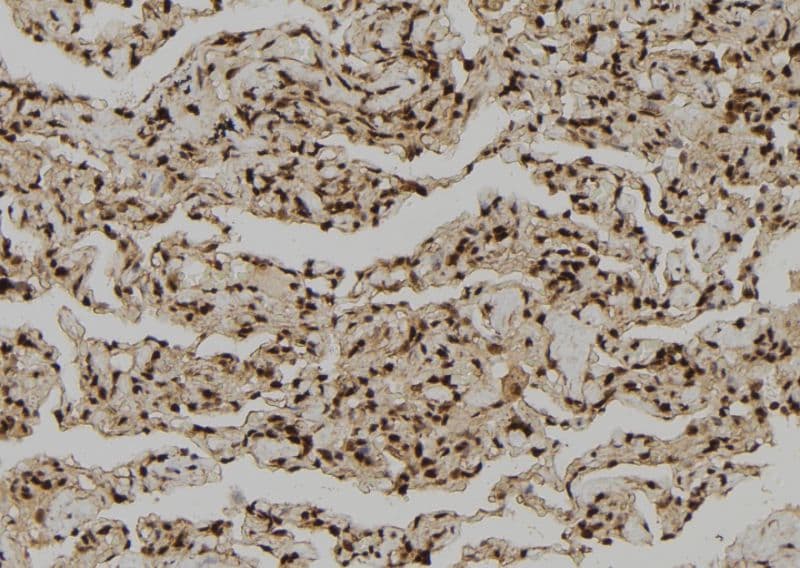 Polyclonal Rabbit anti-Human GZMH / Granzyme H Antibody (IHC, IF, WB)