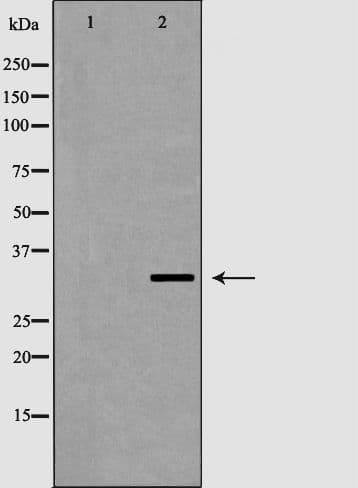IHC-plus™ VDAC2 Antibody