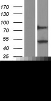 PPARD / PPAR Delta Protein (Over-Expression Lysate Myc-DDK (Flag))