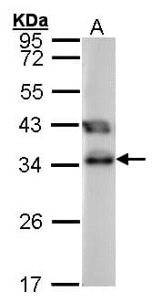 Polyclonal Rabbit anti-Human TTC1 Antibody (aa1-210, WB)