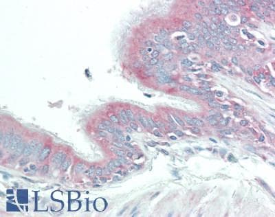 IHC-plus™ Polyclonal Rabbit anti-Human PTGER2 / EP2 Antibody (IHC, WB)