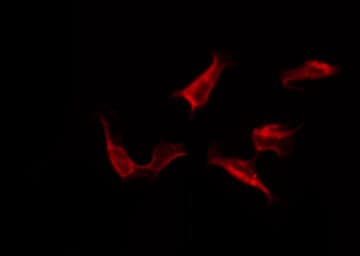 EGFR Antibody (phospho-Tyr1172)