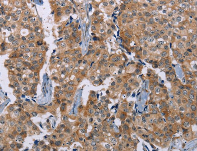 PLXNA4 / Plexin A4 Antibody