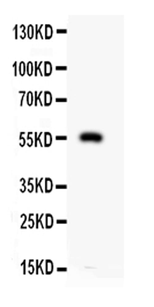 MMP12 Antibody (aa432-466)