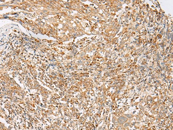 FKSG89 / MBOAT4 Antibody