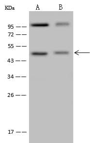 Polyclonal Rabbit anti-Human DNAJB4 Antibody (WB)
