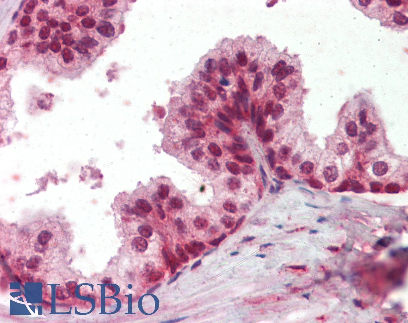 IHC-plus™ PPP4C Antibody (aa290-301)