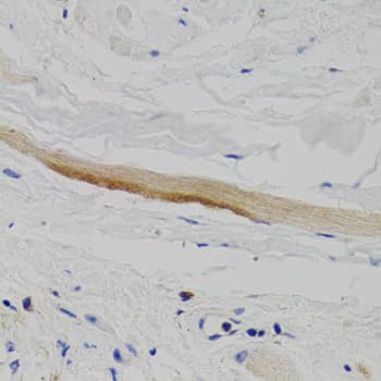 PTPN11 / SHP-2 / NS1 Antibody
