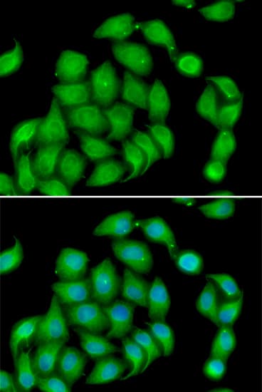 Junctin / ASPH Antibody
