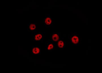 RASSF2 Antibody