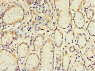 Polyclonal Rabbit anti-Human EXO1 Antibody