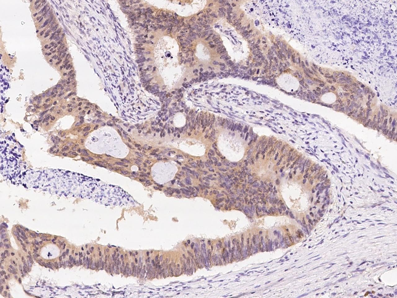 PCF11 Antibody