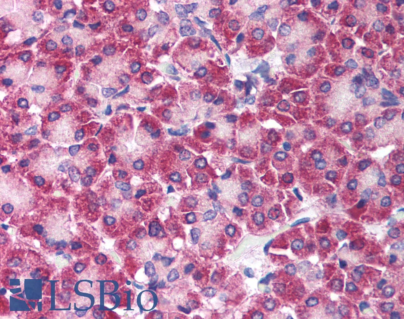 IHC-plus™ IKBKB / IKK2 / IKK Beta Antibody