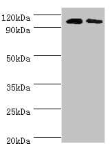 Polyclonal Rabbit anti-Human ALDH1L1 Antibody (aa1-250, IHC, WB)
