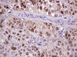 PCNA Antibody (clone OTI4B2)