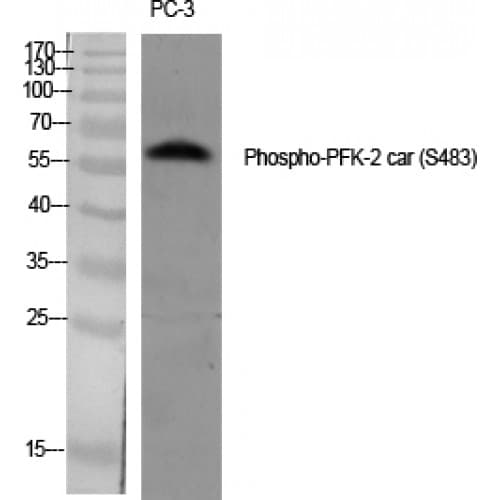 PFKFB2 Antibody (420-500 aa)