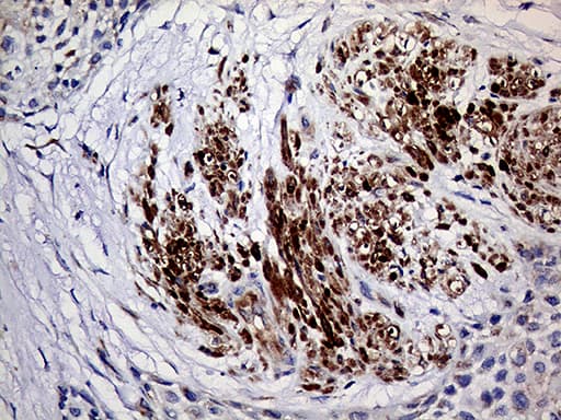 Monoclonal Mouse anti-Human TGM2 / Transglutaminase 2 Antibody (clone OTI4H5, IHC, WB)