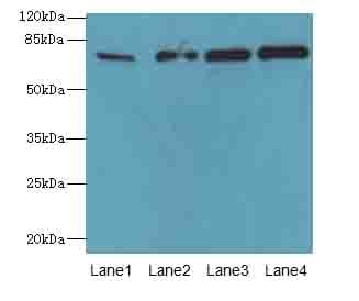 TBC1D14 Antibody
