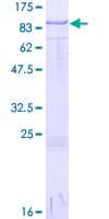 Human BMP1 Protein (Recombinant GST)