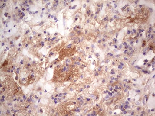 CFI / Complement Factor I Antibody (aa340-583, clone OTI2B5, Carrier-free)