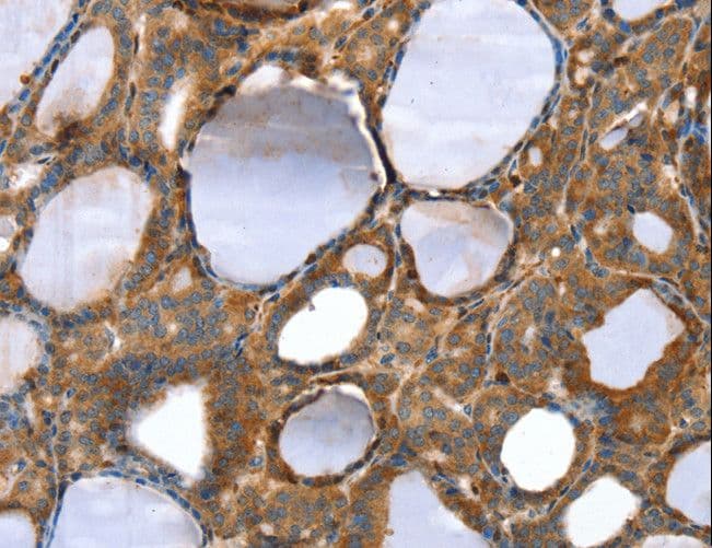 TAGLN / Transgelin / SM22 Antibody