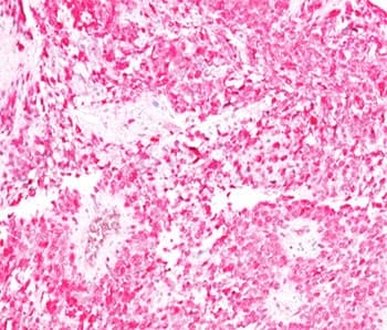 S100B / S100 Beta Antibody (clone 4C4.9)