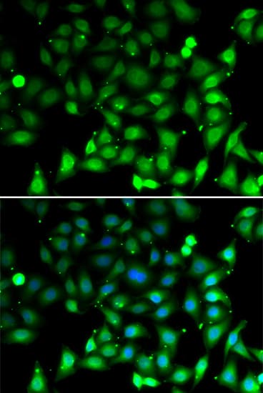 Polyclonal Rabbit anti-Human MRNP41 / RAE1 Antibody (IHC, IF, WB)