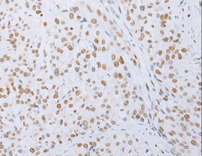 MCM2 Antibody