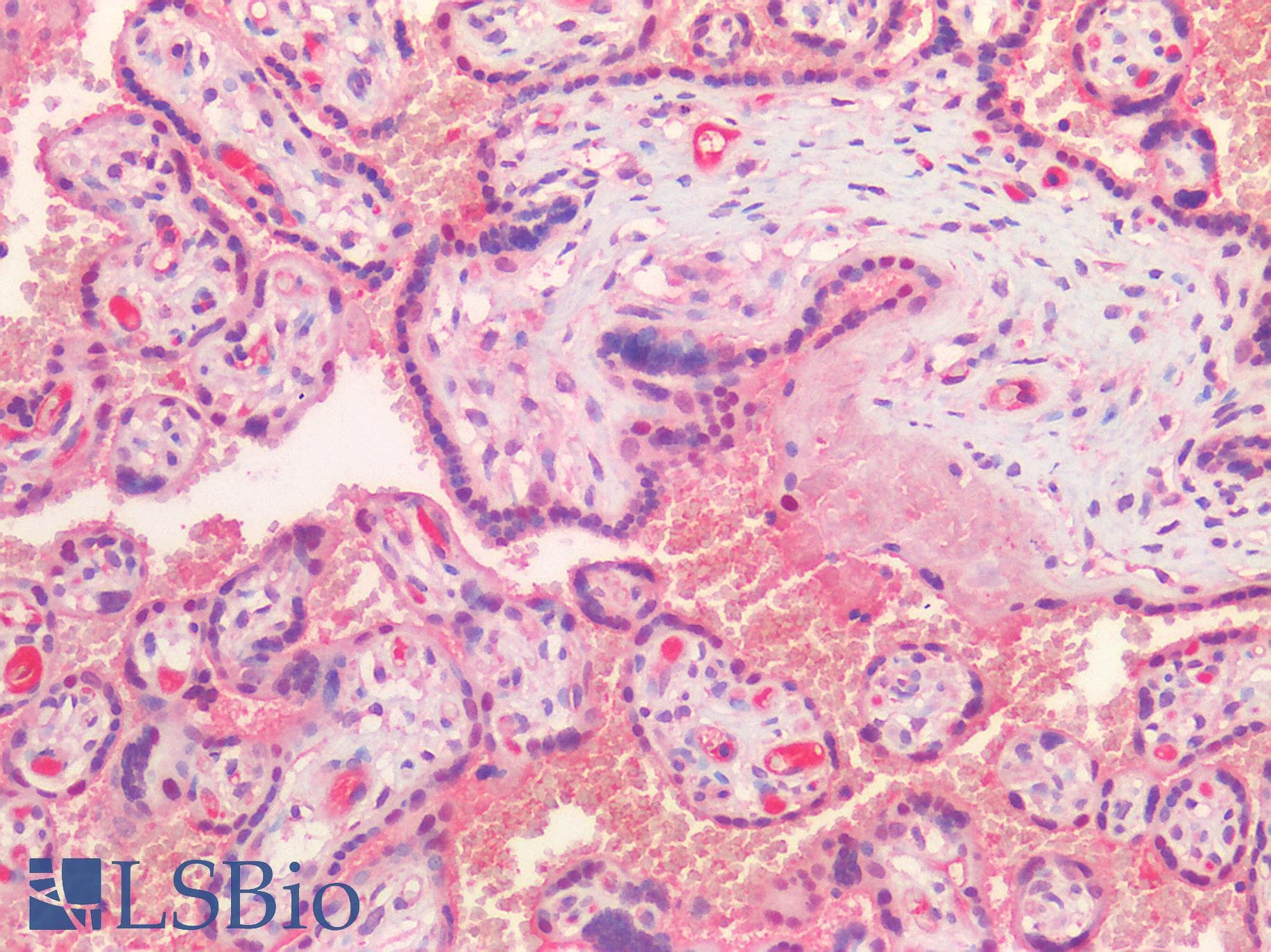 IHC-plus™ HGF / Hepatocyte Growth Factor Antibody