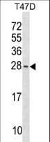 Polyclonal Rabbit anti-Human BAX Antibody (aa69-98, WB)