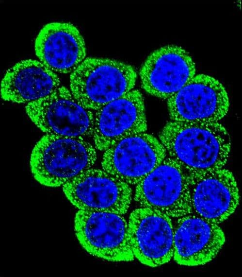 MMP13 Antibody (aa253-282)