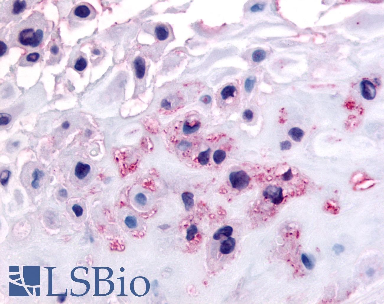 IHC-plus™ NEP / DDR1 Antibody (C-Terminus)