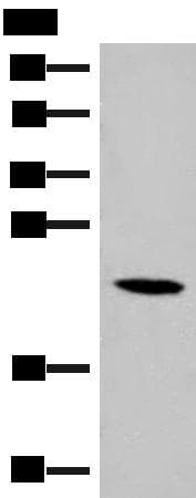 DHFR Antibody