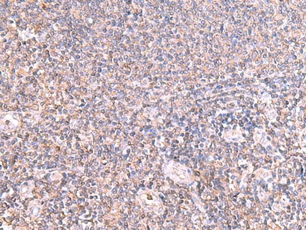 Polyclonal Rabbit anti-Human IFT57 / HIPPI Antibody (IHC)