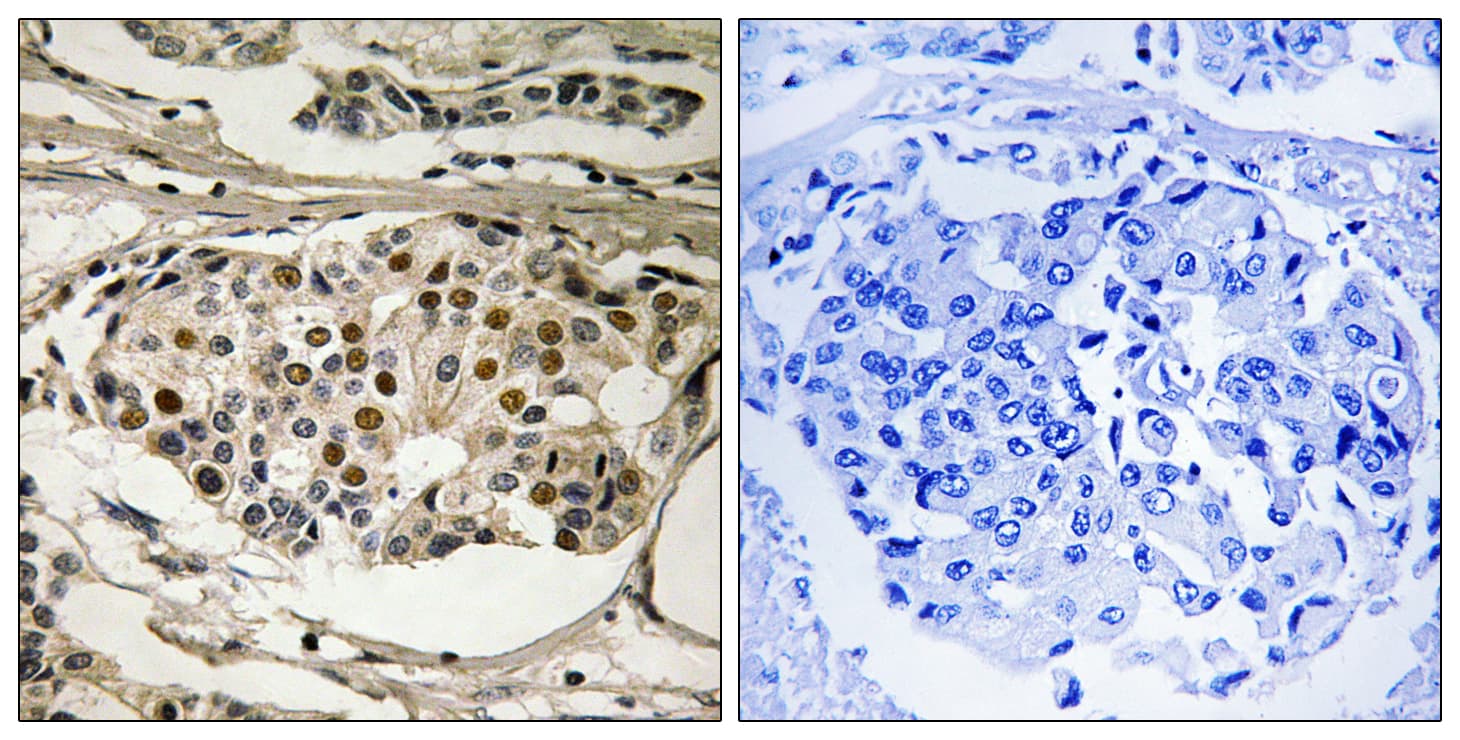 Polyclonal Rabbit anti-Human RELA / NFKB p65 Antibody (phospho-Ser281, IHC)